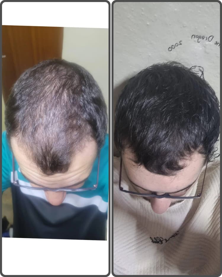 Person holding product